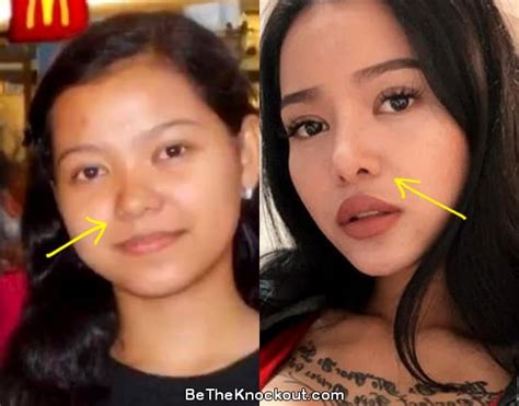 bella poarch before surgery|Bella Poarch Before Plastic Surgery